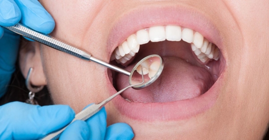 Photo of a dentist working on a person's open mouth.